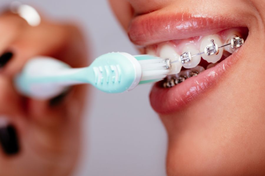 Braces & Orthodontic Care