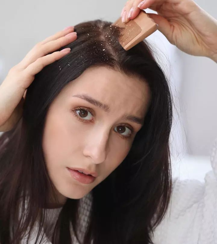 Dandruff Treatment