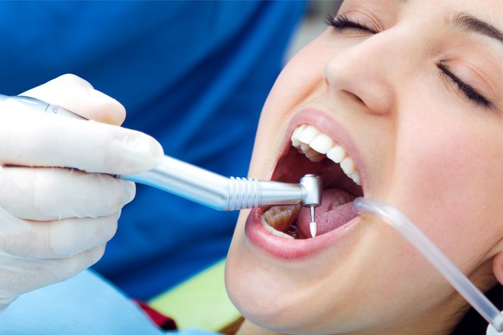 Tooth Fillings & Restorations